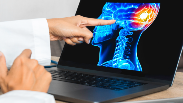 Adjusting to Life After a TBI: Guidance From Our Legal Team